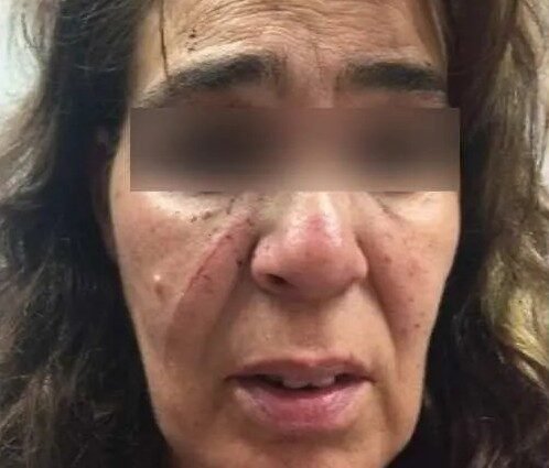 A martillazos la quiso matar, está muy Lucrecia