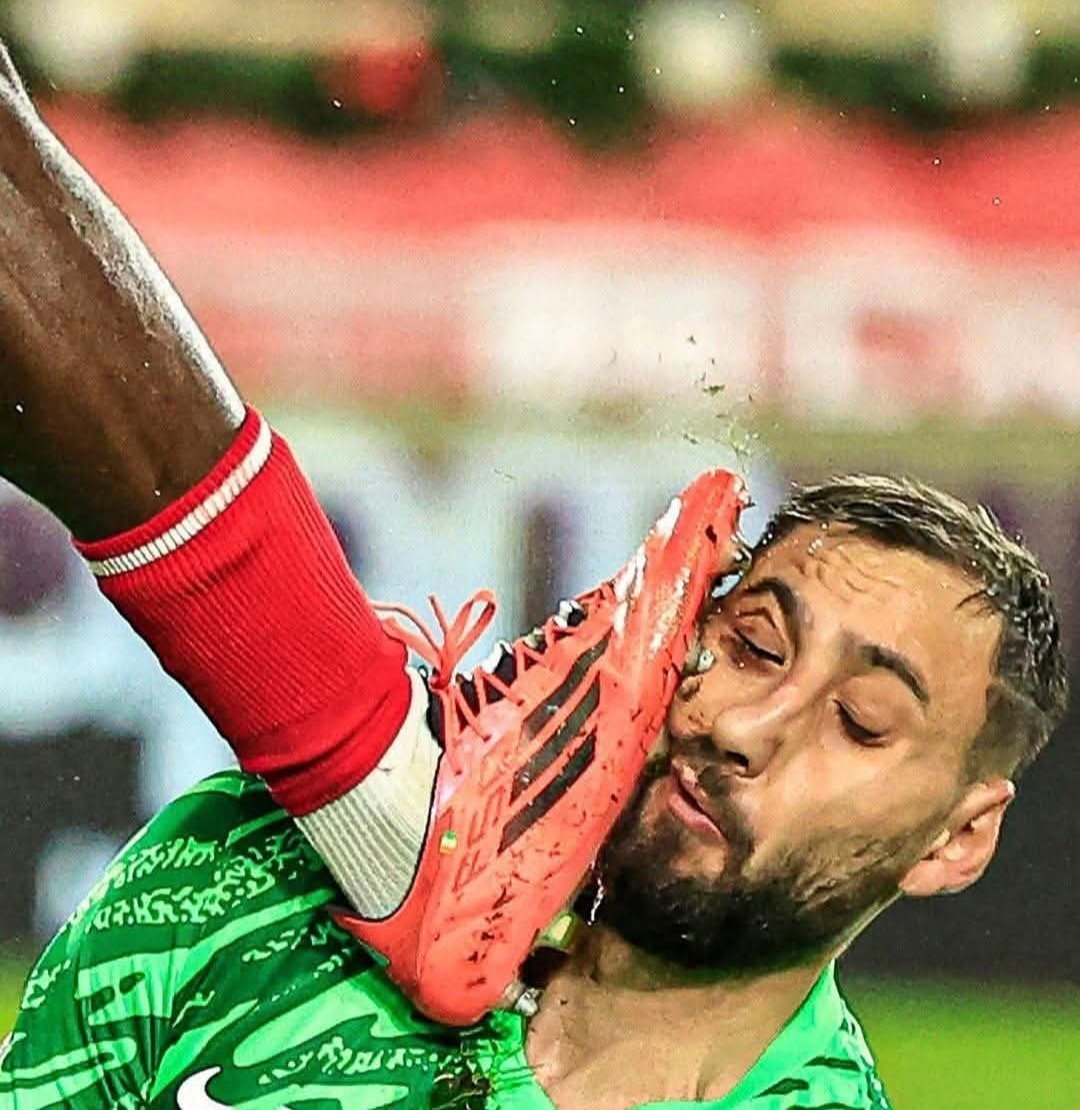 Ahhh que dolor, el portero  del PSG Gianluigi Donnarumma sufrió una grave lesión.