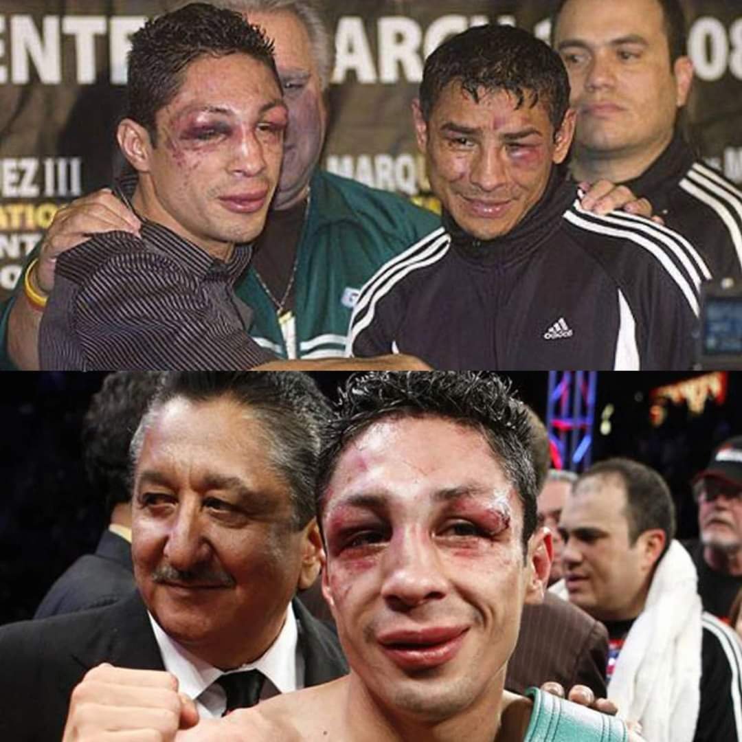 Muere el boxeador mexicano Israel ‘Magnífico’ Vázquez.