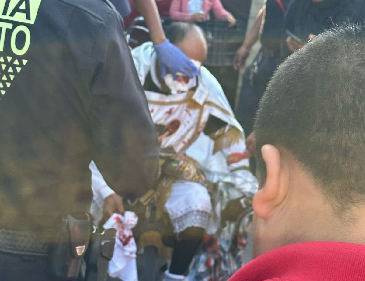 Carnaval de de  Huejotzingo es nota nacional, manos sin dedos, campales y maltrato animal