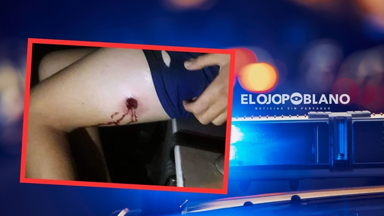 Apareció de la nada y plomea a joven en colonia Universidades